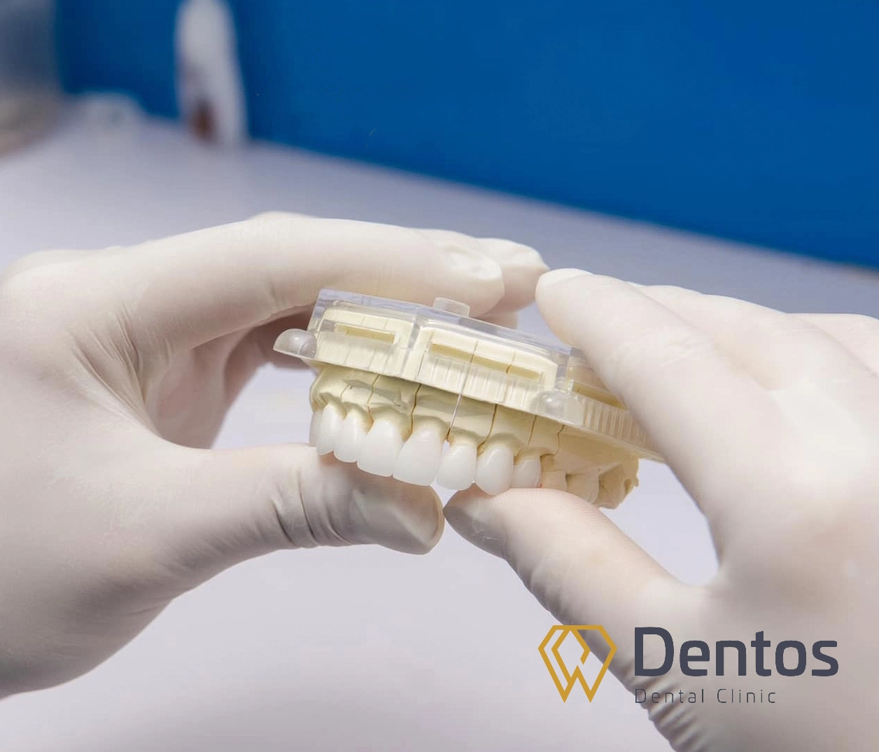 Mão răng sứ Zirconia có độ bề cao, khả ăn chịu lực ăn nhai tốt